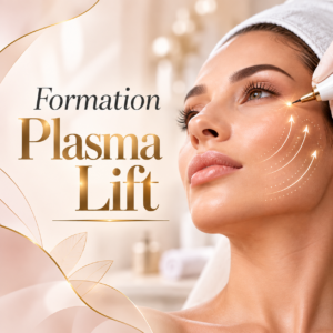 Formation plasma lift